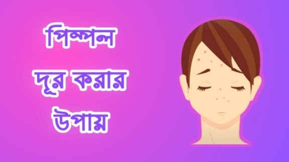 পিম্পল দূর করার উপায় : ব্রণের হাত থেকে চিরতরে মুক্তি চান তো?